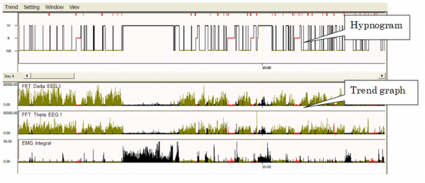 time scale graph. on the same time scale.